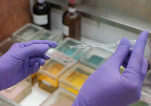 Lee más sobre el artículo La citología, una prueba que te puede salvar la vida